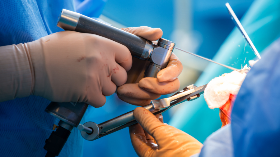 knee_replacement_surgery