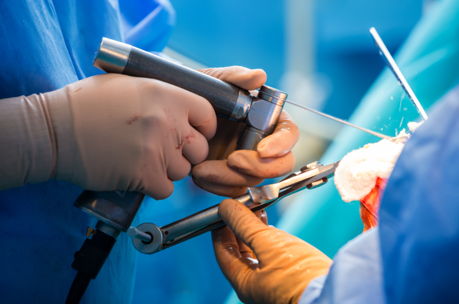 knee_replacement_surgery