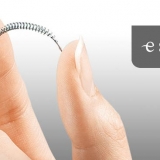 essure